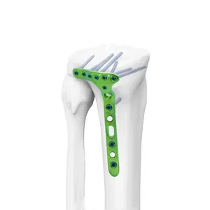 Sistem Implan Fiksasi Fraktur Tulang Pelat Pengunci Trauma Bedah Ortopedi Titanium untuk Tulang Humerus, Femur, Tibia, dan <span class=keywords><strong>Radius</strong></span> - Product Image 3