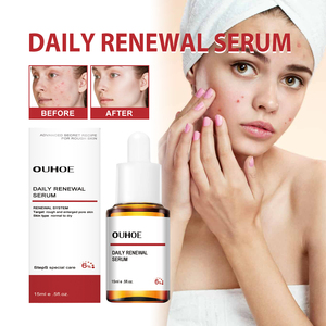 OUHOE acido mandelico per essenza OBM aggiornamento quotidiano Acne-rimozione e riparazione di acido di frutta schiarente per l'essenza per la pelle - Product Image 2