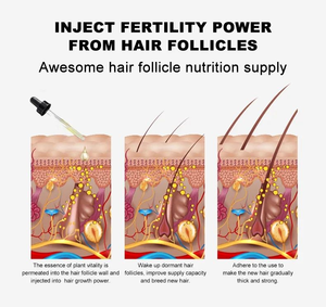 Huile essentielle de ginseng de haute qualité de marque privée accélère la croissance des <span class=keywords><strong>cheveux</strong></span> Vitamines huile de soin capillaire naturelle pure huile de gingembre King of - Product Image 4