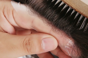 Toupet da Uomo in Stock con V-loop su Base in Poliuretano Sottile, Densità Extra Leggera 80%, Sistema di Infoltimento per Uomo - Product Image 3