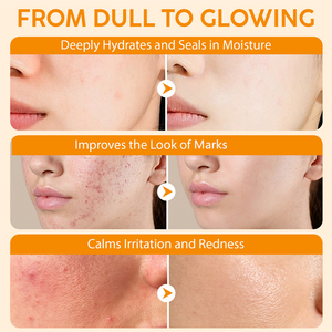 Elaimei 60g hydratant nourrissant anti-âge rougeurs poches ridules réduisant le suif huile de ricin encens baume pour la peau - Product Image 3
