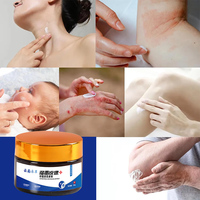 Crème pour l'eczéma à marque privée OEM, éclaircissante, à base de plantes, antifongique, apaisante en profondeur, nouvelle crème chinoise, meilleure pommade anti-démangeaisons