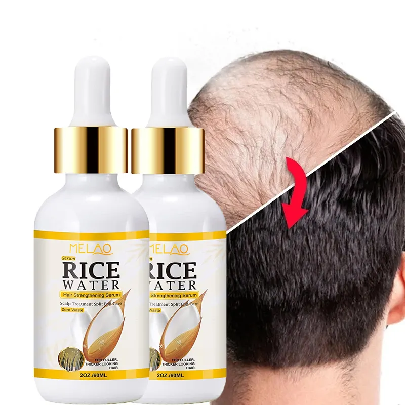 Sérum de renforcement des cheveux à l'eau de riz Traitement du cuir chevelu Soins des pointes fourchues Croissance des cheveux Riz biologique rapide naturel Sérum anti-chute de cheveux