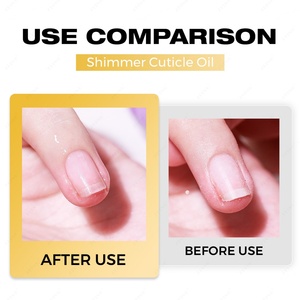 JTING Nuevo Aceite para Cutículas con Brillo, 9 Colores, Aceite Revitalizante Nutritivo, OEM/ODM, Etiqueta Privada, Diseño Gratuito, Aceite para Uñas - Product Image 6