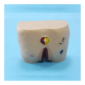 Modèle de soins infirmiers Ulcère de pression pour personnes âgées Modèle d'<span class=keywords><strong>escarre</strong></span> de science médicale pour les patients - Product Image 6