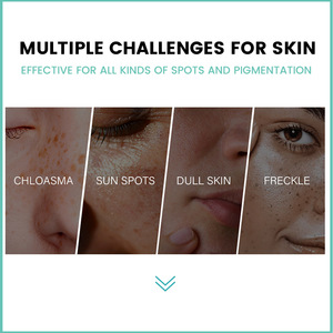 Offre Spéciale 100% ingrédients naturels réveil de la vitalité de la peau soulage les taches du visage et apaise la peau spray de soin Chloasma - Product Image 5