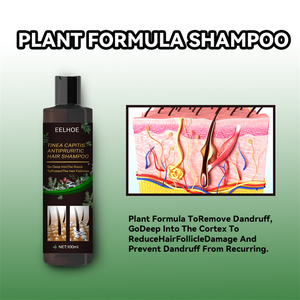 OEM 100mL Tinea <span class=keywords><strong>Capitis</strong></span> Champú antipruriginoso para el cabello Anti caspa ácaros Eliminación de Tinea <span class=keywords><strong>Capitis</strong></span> Acarus <span class=keywords><strong>Tratamiento</strong></span> Champú para el cabello - Product Image 5