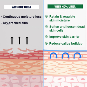 FATAZEN Etiqueta Privada 40% Urea Crema Hidratante Intensiva Aceite de Coco Aloe Vera Fórmula Pies Codos Rodillas Reparación Crema Corporal - Product Image 5