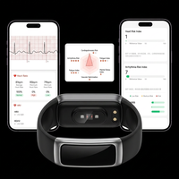 Bracelet intelligent sans écran, ECG, fréquence cardiaque, sommeil, moniteur de pression artérielle, rappel sportif, montre de santé unisexe