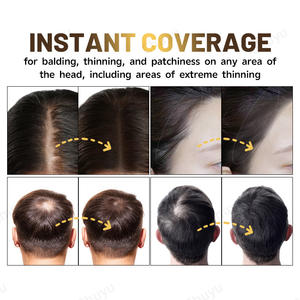 Polvo de línea capilar para mujeres y hombres, utilizado para retocar el color del cabello, cobertura de cabello delgado y gris y cobertura de puntos calvos - Product Image 5