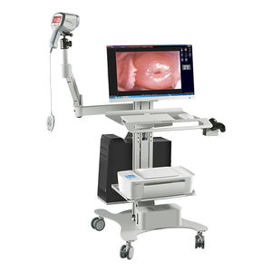 Colposcópio Digital Eletrônico KN-2200I para Uso Hospitalar, Fabricado na <span class=keywords><strong>China</strong></span> - Product Image 1