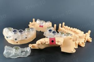 Impresora <span class=keywords><strong>RITON</strong></span>, Producción Digital Conveniente para Consultorio Dental, Impresora 3D de Resina - Product Image 6