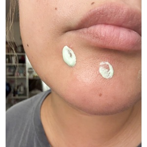 Traitement Correcteur des Rougeurs à Marque Blanche avec 1,5 % d'Acide Salicylique – Réduit les Rougeurs et Traite les Imperfections - Product Image 5