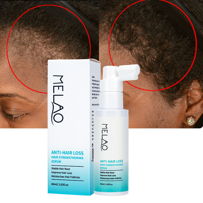 Natural Fast Hair Growth Serum Scalp