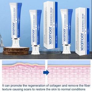 Gel réparateur cutané naturel à base de plantes OEM, éclaircissant le teint, atténuant <span class=keywords><strong>les</strong></span> marques d'acné, <span class=keywords><strong>les</strong></span> <span class=keywords><strong>vergetures</strong></span> et <span class=keywords><strong>les</strong></span> cicatrices - Product Image 6