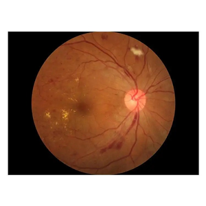 China oftalmal Retina Camera SK-650B Eye Test Camera Retina Fundus Camera - Product Image 4