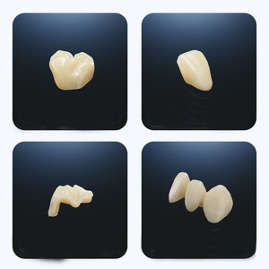 Impresora 3D Pionext Mini, Comercial, de Escritorio, Automática, LCD, Resina, Todo en Uno, Solución de Impresión Dental, Impresoras de Gran Formato - Product Image 6