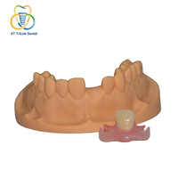 Prothèse dentaire partielle amovible en nylon thermoplastique flexible de haute qualité, prothèse dentaire personnalisée