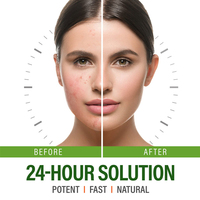 Crème Visage Anti-Acné 100g Hydratante & Séborégulatrice, Débouche les Pores et Atténue l'Acné