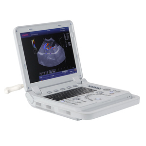 Ecografo Portatile CONTEC CMS1700B, Strumento Medico a Ultrasuoni 3D 4D con Doppler a Colori - Product Image 4