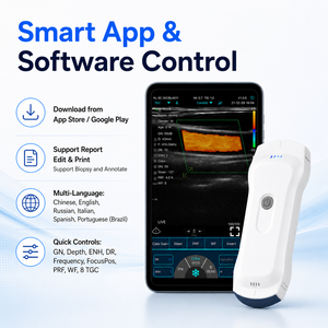 Sonda USB WiFi Inalámbrica Portátil para Ultrasonido Doppler Color Veterinario de Abdomen, Cardíaco y Vascular - Product Image 6