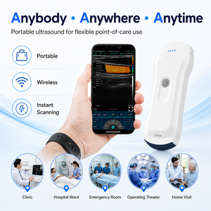 Sonda USB WiFi 3 en 1 para Uso Veterinario Clínico, Ecógrafo <span class=keywords><strong>Doppler</strong></span> Color Portátil - Product Image 1