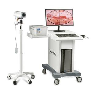 KN-2200 Kernel peralatan medis Harga Murah <span class=keywords><strong>Colposcope</strong></span> Video Digital kualitas bagus kamera <span class=keywords><strong>Colposcope</strong></span> - Product Image 1