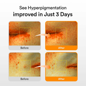 Suero Nocturno para Aclarar Manchas Oscuras, Hidratante, Revitalizante, con Cápsulas de Perla para el Cuidado Facial - Product Image 5