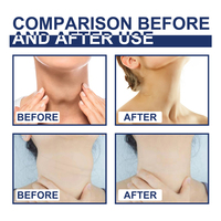 Patchs OEM Glande Thyroïde Lymphatique 20 Pièces pour Traitement de l'Hyperthyroïdie, Thyroïdite et Goitre