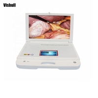 Caméra endoscopique portable équipement d'imagerie médicale caméra endoscopique HD pour ORL/laparoscopie/hystéroscopie/urologie