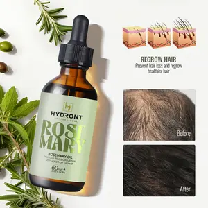 Private Label Organic Hair Care Loss Treatment Rosemary Essential Oil Indian Hair Growth Oil