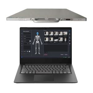 MECANMED Médico X Ray Detector De Tela Plana Sistema DR Cmos Sem Fio Xray De Tela Plana Veterinária Digital De Tela Plana - Product Image 6