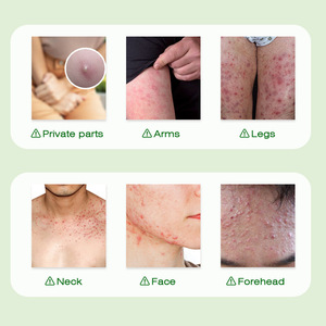 Crème apaisante pour les follicules pileux avec formule aux herbes naturelles pour une utilisation quotidienne - Product Image 4