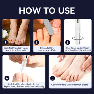 Liquido Riparatore per Unghie a Base di Erbe, Trattamento Antibatterico e Nutriente per Unghie di Mani e Piedi, Vendita all'Ingrosso - Product Image 6