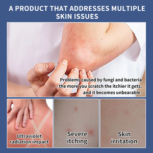 Crème antibactérienne et anti-démangeaisons à base de plantes, marque privée, pour l'eczéma, le psoriasis, le prurit, soulage les démangeaisons des mains, des pieds et des parties anales, vente en gros OEM - Product Image 6