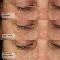 Sérum pour les yeux au collagène végétalien de marque privée crème pour les yeux au peptide d'acide hyaluronique pour réduire les cernes