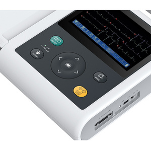 PE-VE3B Electrocardiógrafo Veterinario Digital de 12 Canales/derivaciones, Económico, Electrocardiógrafo Médico de 12 Derivaciones a Bajo Precio - Product Image 6
