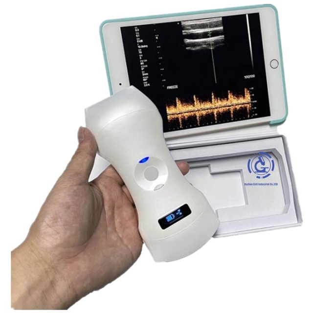Wireless Medical Ultrasound Probe Portable and Convenient for Diagnostic Imaging