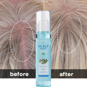 Producto Orgánico para el Cuero Cabelludo OEM/ODM, Aceite de Menta, Mentol, Brillo Capilar, Cuidado del Cabello, Anti-Picazón, Reparación del Cuero Cabelludo, Spray Capilar - Product Image 3
