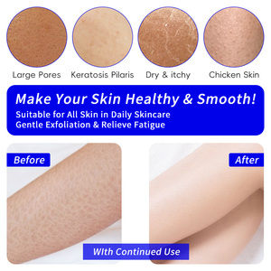 Gant exfoliant léger en viscose marocaine Kessa <span class=keywords><strong>Hammam</strong></span> pour hommes et femmes, brosse pour éliminer les peaux mortes pour la salle de bain - Product Image 6