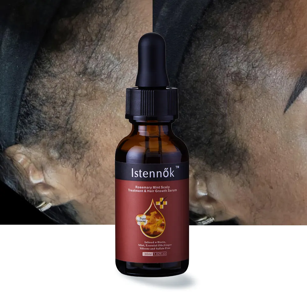 ISK Strong Effect Haarwuchs Serum natürliches schnelles Haarwuchs öl für Frauen Männer