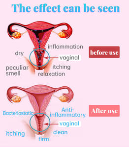 7 Capsules Resserrement <span class=keywords><strong>Vaginal</strong></span> Vagin Rétrécissement Hygiène Féminine Réparation Pilules Raffermissant Vagin Femme Soins Infirmiers Privés - Product Image 6