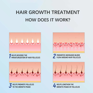 BEAUTRUE 4 mesi di trattamento ricrescita dei <span class=keywords><strong>capelli</strong></span> schiuma per gli uomini perdita di <span class=keywords><strong>capelli</strong></span> ricrescere più folta fornitura non profumata per la crescita dei <span class=keywords><strong>capelli</strong></span> schiuma Spray - Product Image 5