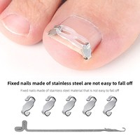 Kit de Correction des Ongles Incarnés en Acier Inoxydable avec Outil d'Installation et Patch de Correction