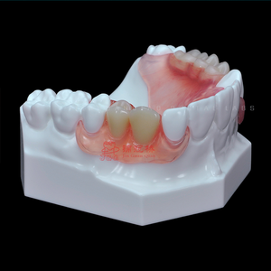 Rimovibile flessibile completa completa protesi tradizionale in acrilico denti finiti laboratorio di protesi dentale cina - Product Image 4