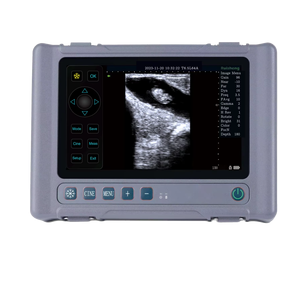 Sistema de Imagem Diagnóstica por Ultrassom Bovino T1 para Uso Animal, Máquina de Ultrassom para Vacas - Product Image 1