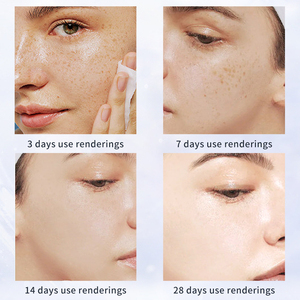 OEM Kit de soins de la peau de beauté coréen pour le visage ensemble de rajeunissement crème blanchissante hydratante éclaircissante niacinamide ensemble de soins de la peau des yeux (nouveau) - Product Image 2