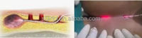 980nm1470nm Diode Laser Excision Hémorroïde Proctologie Fistule Hémorroides Traitement Piles Remover Pilonidal Sinus Fissure