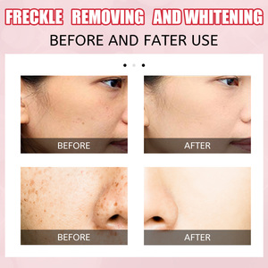 Crème pour le visage blanchissante pour la peau Crème hydratante éclaircissante Acide kojique Hydratant Crème d'embellissement de la peau Taches éclaircissantes - Product Image 4