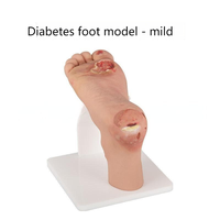 Modelo de pie diabético (leve/grave) para entrenamiento médico y educación